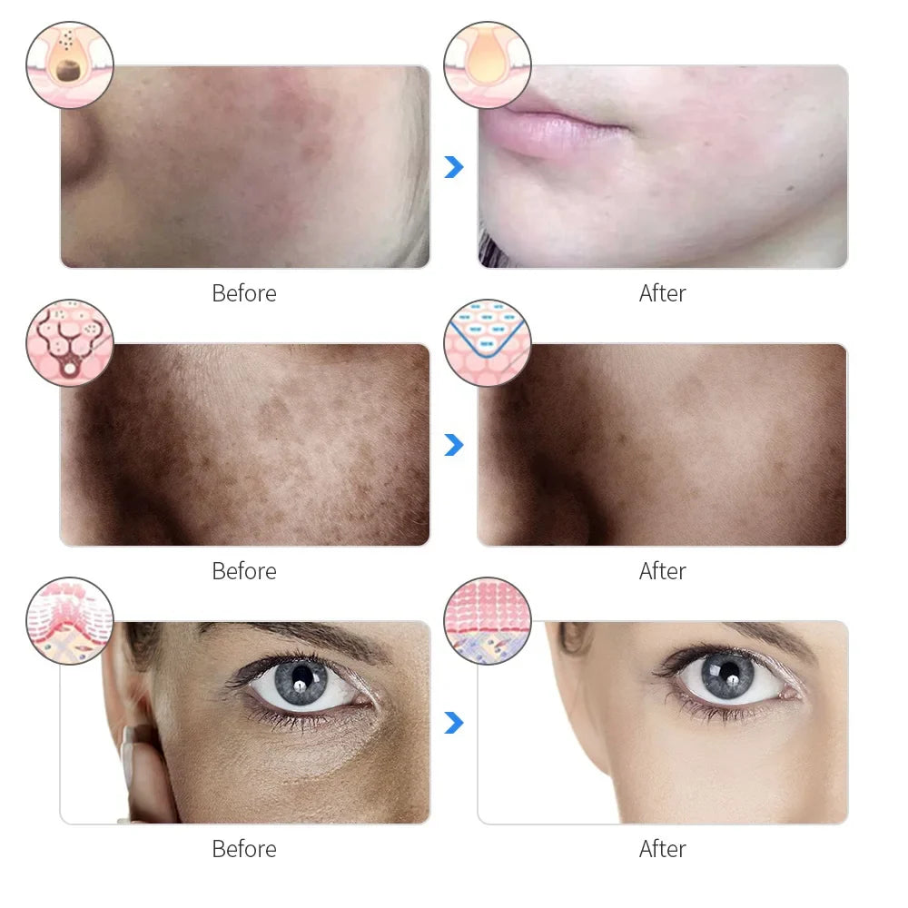 Máscara facial LED recargable de 7 colores para terapia de luz, máscara facial LED para terapia de luz en casa, máscara de terapia de luz azul y roja para rostro, dispositivos faciales